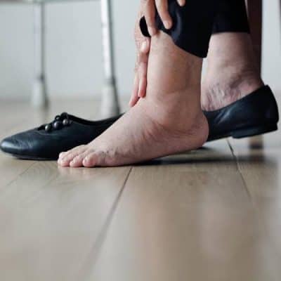 اسباب تورم القدمين عند كبار السن