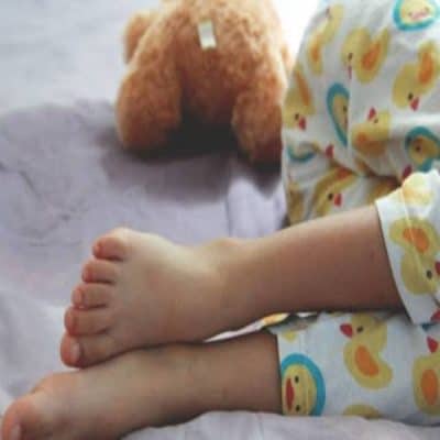 علاج التبول اللاإرادي للاطفال