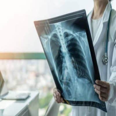 علاج التهاب الشعب الهوائية والبلغم بالاعشاب