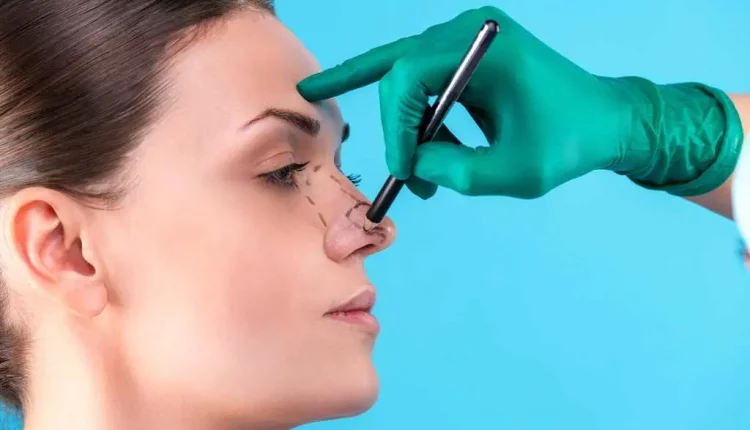 تجميل الانف