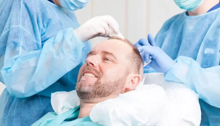 زراعة الشعر | الفوائد والأضرار وأحدث التقنيات المستخدمة